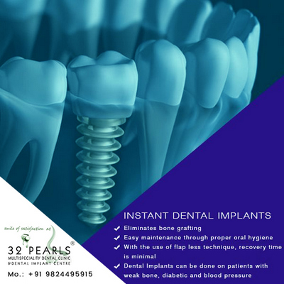 Best Dental Implants Treatment in Ahmedabad at attractive price, Ahmedabad, Gujarat, India