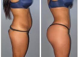 HIPS AND BUMS ENLARGEMENT CREAM AND PILLS +27605775963, Central, New South Wales, Australia