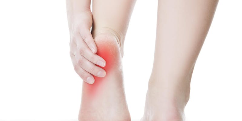 Heel Pain Solutions: Practical Recovery Workshops, Singapore, Central, Singapore
