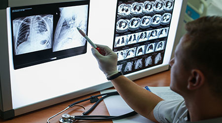 Interpretation of Chest Radiographs for the Nonradiologist - Online, Rochester, Minnesota, United States