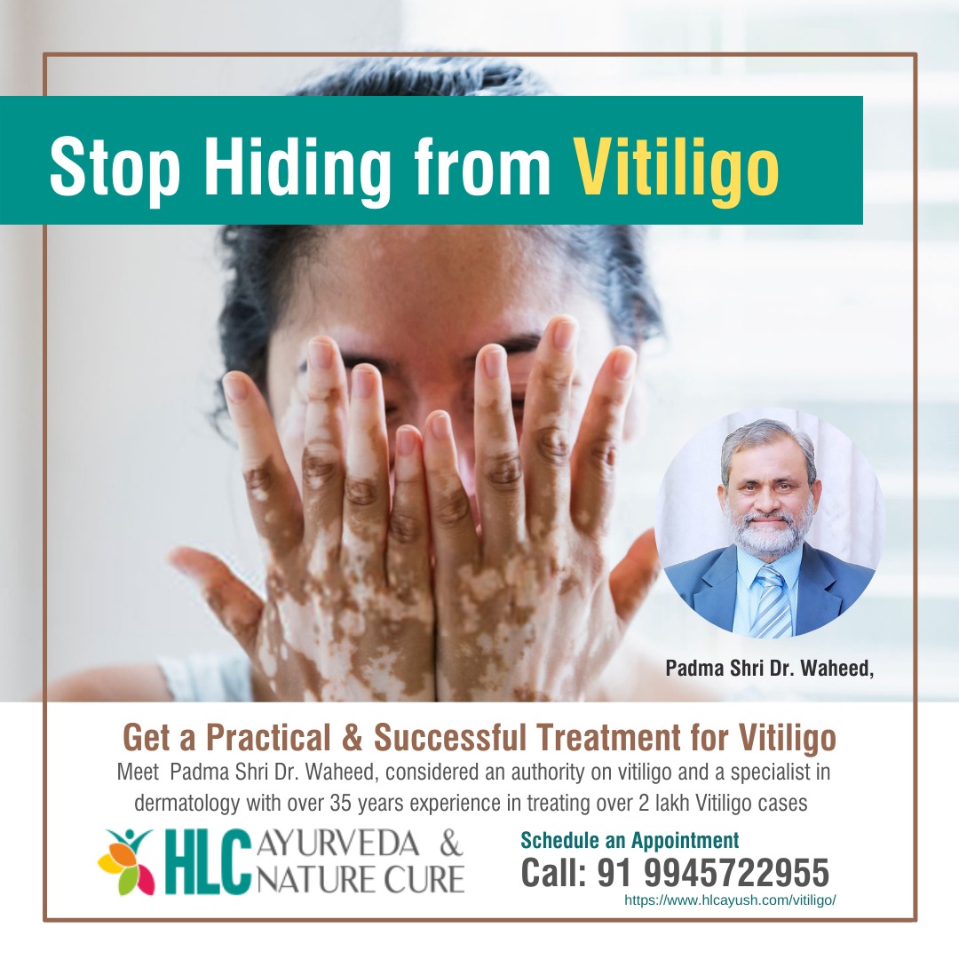 Vitiligo, Psoriasis and Eczema | Management & Treatment, Bangalore, Karnataka, India