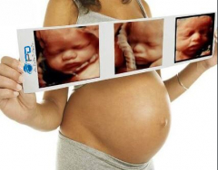 Pioneer: The Leading Pregnancy Ultrasound Provider for Expectant Women