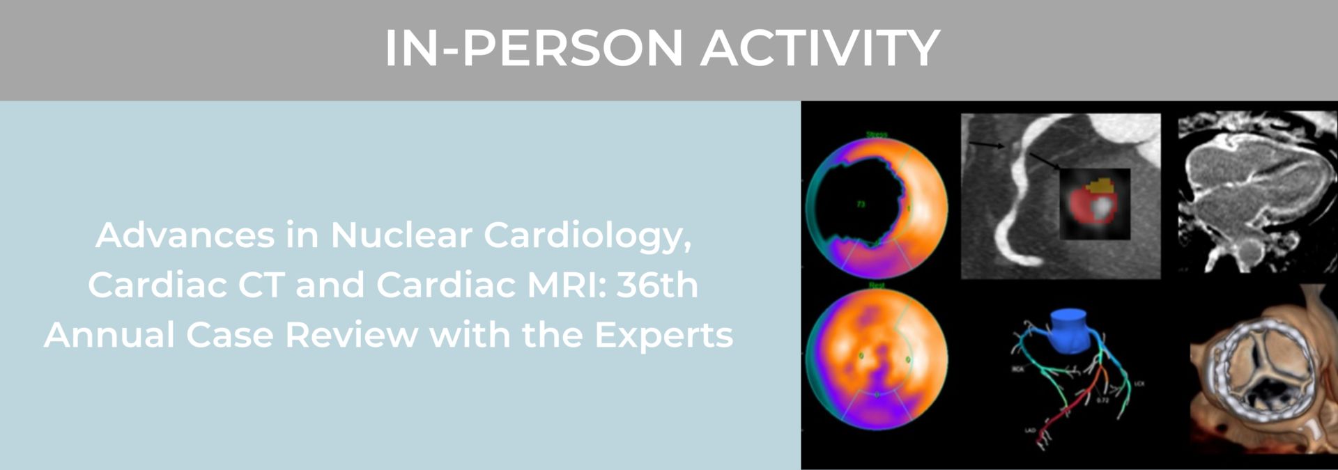 Advances in Nuclear Cardiology, Cardiac CT and Cardiac MRI: 36th Annual Case Review with the Experts, Los Angeles, California, United States