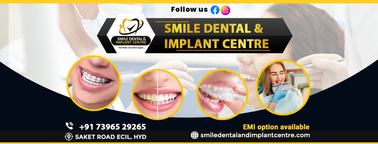 Smile Dental & Implant Centre Offers Advanced Dental Treatment in Ecil, AS Rao Nagar, Hyderabad, Telangana, India