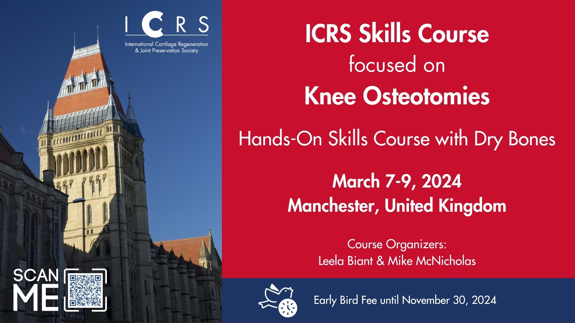 ICRS Skills Course focused on Knee Osteotomies, Manchester, England, United Kingdom
