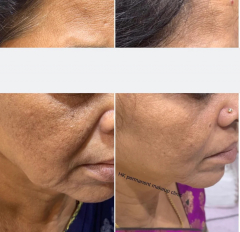 From Saggy Skin to Stunning Skin: Transform Your Skin with Our Proven Techniques